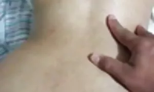 En prolapso anal tem ...