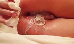 Anal completo orekóv ...